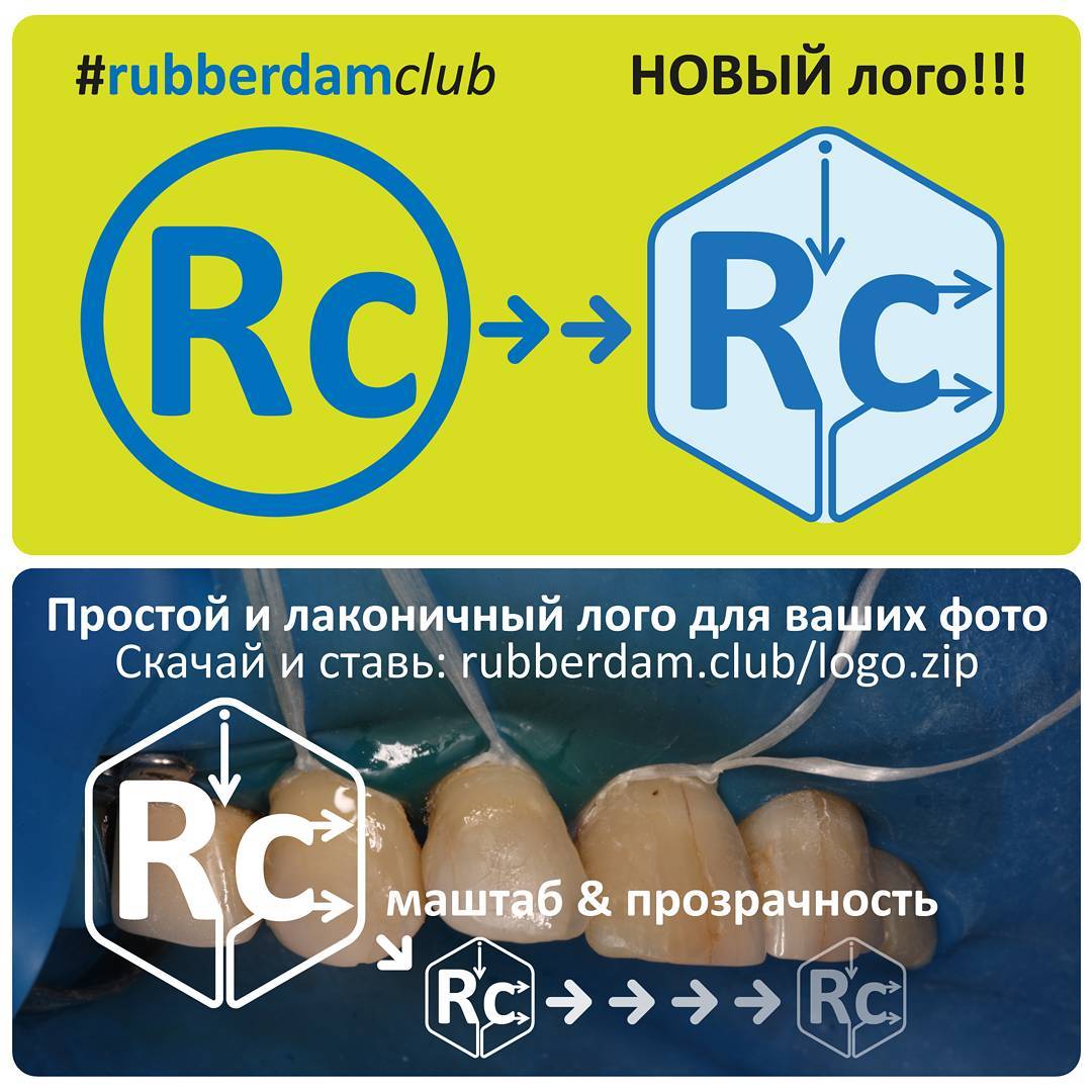 Новый лого у проекта #rubberdamclub Вы так же можете значительно улучшить оформление своих клинических фотографий скачав по ссылке http://rubberdam.club/logo.zip этот лого и наносить его в графическом редакторе в уголочек своих фотографий. Будем вам премного благодарны.